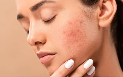 Rejuvenate your skin with skin-lightening treatment